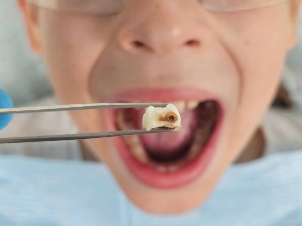 Best Weekend Emergency Dentist in Geneva, IN