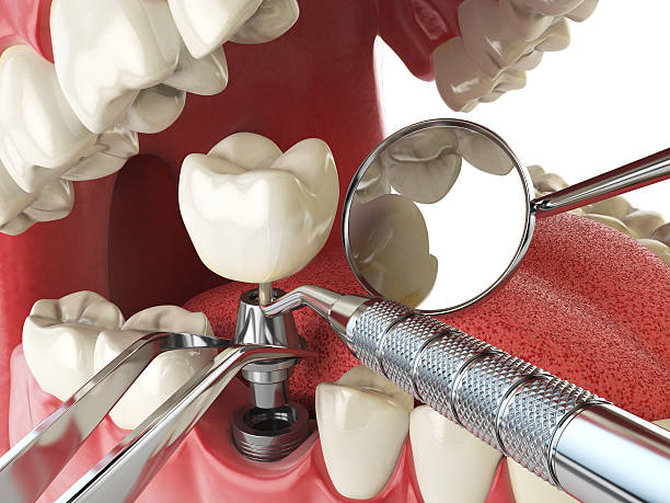Best Weekend Emergency Dentist in Geneva, IN
